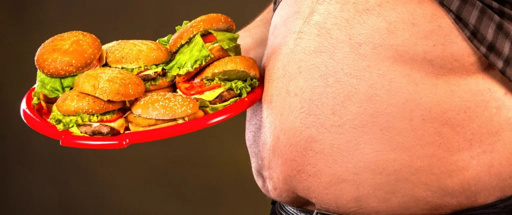 Obezite Başlangıcı 2 obezite